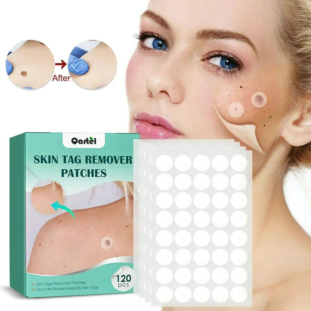 Skin Tag Remover Patch Qartel™